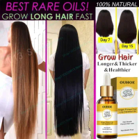 Biotin Fast Hair Growth Spray Oil Hair Regrowth Serum Hair Thinning Treatment Hair Growth Liquid Anti-Hair