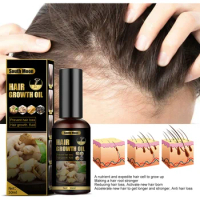 To address baldness. Anti hair loss spray anti hair loss hair nutrition growth agent essence promotes hair growth