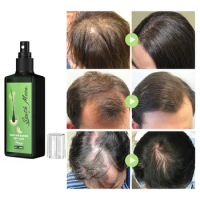 100ml South &amp; Moon Hairs Lotion Spray for Hair Growth Longer Beard Anti Hair Loss Treatment Hair Growth Oil for Black Women
