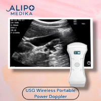 USG Wireless Portable Power Doppler Alat Scan Bayi Tanpa Kabel untuk Kesehatan Ibu dan Bayi