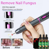 Electric Nail File Repair Nail Fungus Treatments Essence Foot Care Serum Toenail Fungal Removal Gel Anti-Infection Onychomycosis