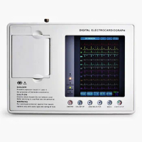 SE-3C digital three channel color touch screen electrocardiogram machine