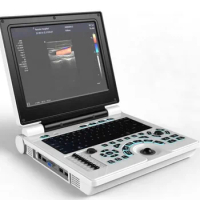 Medical Cardiology portable 12 inch ultrasonic machine digital ultrasound scanner notebook USG color doppler ultrasound system
