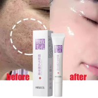 Salicylic Acid Pore Shrinking Cream Quick Elimination Large Pores Smooth Skin Remove Blackehead Tighten Face Korean Care Product