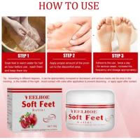 Sdottor Foot care cream anti-freeze cracking moisturizing Anti dry peeling rough cracked Exfoliator removal hands and feet repai