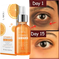 Vitamin C Remove Dark Circles Eye Serum Anti-Wrinkle Fade Fine Line Anti Eye Bag Puffiness Essence Anti-Aging Lift Firm Eye Care