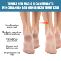Sdottor Feet Moisturizing Cream Anti Dry Cracked peeling remove Callus exfoliation repair heels chapped Anti-Freeze Foot care oi
