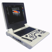 12 Inch LED Screen 2D Notebook Color Doppler PC Echo B Ultrasound Diagnostic Scanner Machine