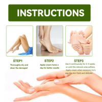 Sdotter New Urea cream hand foot care anti-dry Cracked exfoliation Removal Dead Skin Softening moisturizing hydrating hands feet