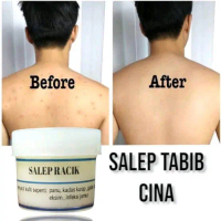 salep tabib cina - mengatasi masalah kulit akibat jamur panu kadas kurap