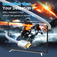 Vention HDMI 2.0 Cable for Xbox Series X Video Audio 4K/60Hz HDMI Switch Cabo HDMI Splitter for Apple TV Xiaomi PS4 HDMI Cable