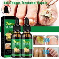 Nail Fungal Treatment Essential Oil Foot Toe Nail Fungus Removal Serum 7 Days Repair Onychomycosi Anti Infection Care Products