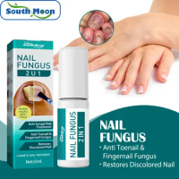 uñas Nail Fungal Treatment Serum Anti Infection Onychomycosis Paronychia Fast Toe Removal Gel Hand Fungal Repair Foot Nail Rapid