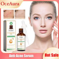 Turmeric Essential Oil Remove Dark Spots Dullness Anti Aging Reduce Acne Repair Redness Whitening Moisturizing Shrink Pore Serum