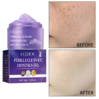 Facial Gel Scrub Remove Melasma Acne Spot Pigment Melanin Dark Spots Exfoliating Cleaning Whitening Moisturizing Smooth Skin