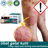 FUKANG Kem nấm ngứa, viêm da dị ứng, vẩy nến.Chiết xuất từ thảo mộc tự nhiên chính hãng 30g