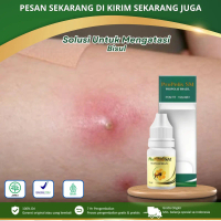Propolis Sm - Untuk Atasi Bisul, Bisul Bernanah, Penghilang Bisul, Bisul Pecah, Bisul Di Badan