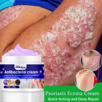 Ready stock original ubat gatal kemaluan dan kulit Krim gatal celah kangkang herb cream skincare30g