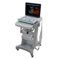 3D Image Function PC Based 15 Inch Notebook B Ultrasound Scanner Machine