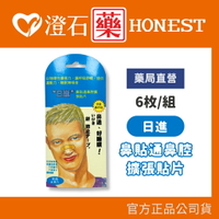 現貨 官方正品 人生製藥 日進 鼻貼通鼻腔擴張貼片 膚色 6枚入 鼻腔擴張 鼻貼通 澄石藥局