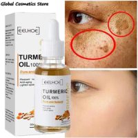 Turmeric Freckle Whitening Serum Curcumin Oil Brighten Fade Dark Spot Removal Pigment Melanin Correcting Beauty Face Skin Care