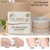 3Sizes Self-Adhesive Silicone Gel Tape Patch Silicone Gel Efficient Beauty Scar Removal For Acne Burn Scar Reduce
