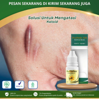 Propolis Sm -  Untuk Atasi Keloid, Penghilang keloid, Penghilang bekas tindik di telinga, Obat Tetes