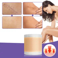 Silicone Scar Tape Painless Silicon Gel Scar Repair Tape for