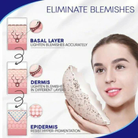 Pro.W Blemish Cream Freckles Acne Pimple Scar Dark Spots Removal Whitening effective face skin Blemish Cream