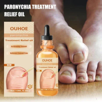 Onychomycosis Paronychia Treatment Nail Fungus Treatment Serum Toe Fungal Repair Products Foot Care Removal Gel Anti Infection