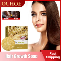 Hair Growth Shampoo Bar Prevent Baldness Dandruff Scalp Treatment Itching Oil Control Thick Nourish Anti Hair Loss Ginger Soap