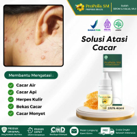 Propolis SM Mengatasi Cacar, Herpes Kulit, Campak, Luka Cacar, Cacar Bernanah, Salep Penghilang Beka