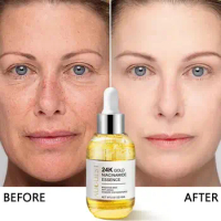 24k Gold Facial Serum Fade Fine Lines Niacinamide Face Serum Dark Spots Remover Hyaluronic Acid Whitening Moisturizing Skin Care