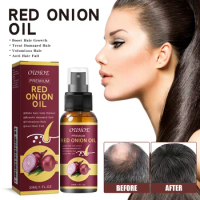 30ML Onion Black Seed Oil Spray for Natural Hair Care Growth Prevent Hair Loss Biotin Fast Hair Growth Hairs Growth Serum Spray