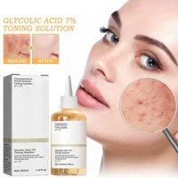 Toner Remove Acne Fade Acne 7% Glycolic Acid Marks Hydrating Whitening Moisturize Toning Ordinary Original Products Improve Skin