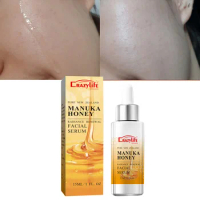 Manuka Honey Gold Face Serum Repairing Essence Moisturizing Oil Control Shrink Pores Lifing Anti-wrinkle Face Serum