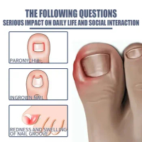 SdatterNail Fungus Treatments quickly Anti fungal Foot toe Nails Repair Gel Anti-Infection Onychomycosis Removal Paronychia oil