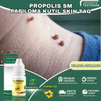 Mengatasi Kutil Papiloma, Daging Tumbuh / Skin Tag Wajah , Jerawat Punggung, Kutil di Leher dan Tang
