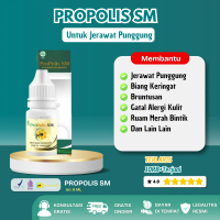 Propolis Sm Suplemen Kesehatan Untuk Jerawat Punggung Biang Keringat Gatal Ruam Merah Beruntusan