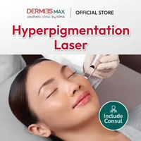 Dermies Max Hyperpigmentation Laser