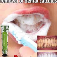 Remover Dental Calculus Toothpaste Whitening Teeth Mouth Odor Oral Care Removal Bad Breath Preventing Periodontitis V34 Care