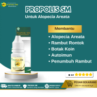 Propolis Sm Untuk Alopecia Areata Rambut Rontok Botak Koin Penumbuh Rambut Anak Dan Dewasa