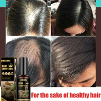 Anti hair loss spray anti hair loss hair nutrition growth agent essence promotes hair growth.Take good care of your hair