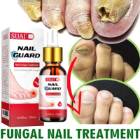 발톱무좀 Nail Fungal Treatment Serum Onychomycosis Paronychia Anti Infection Toe Fungus Hand Foot Removal Repair GelCare Beauty uñas