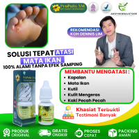 Herbal Atasi Kutil Kapalan Mata Ikan Kaki/Obat Penghilang Kutil Mata Ikan /Obat Kutil mata ikan kapa