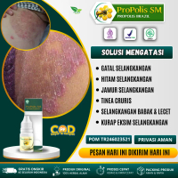 Propolis SM - Untuk Selangkangan Gatal, Selangkangan Hitam , Jamur Selangkangan, Tinea Cruris, Salep