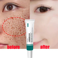 Salicylic Acid Pore Shrinking Cream Large Pores Tightening Repairing Serum Moisturizing Oil Control Korean Cosmetic Skin Care