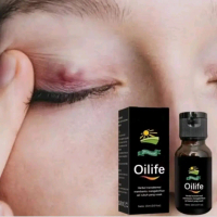 obat benjolan ditubuh minyak oles oilife