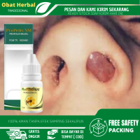 Cairan Tetes Benjolan di Hidung, Polip Hidung, Hidung Tersumbat, Sakit Hidung, Hidung Bau, Sinusitis