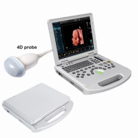 2D 3D 4D 5D(HD Live) 15 Inch LED Ecograph Laptop Notebook Color Doppler Ultrasound Scanner Echo Machine